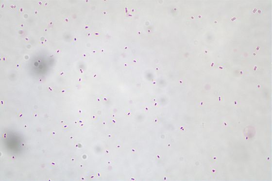 Akkermansia Muciniphila AKK016 AKK Off White To Light Gray Powder/ Probiotics