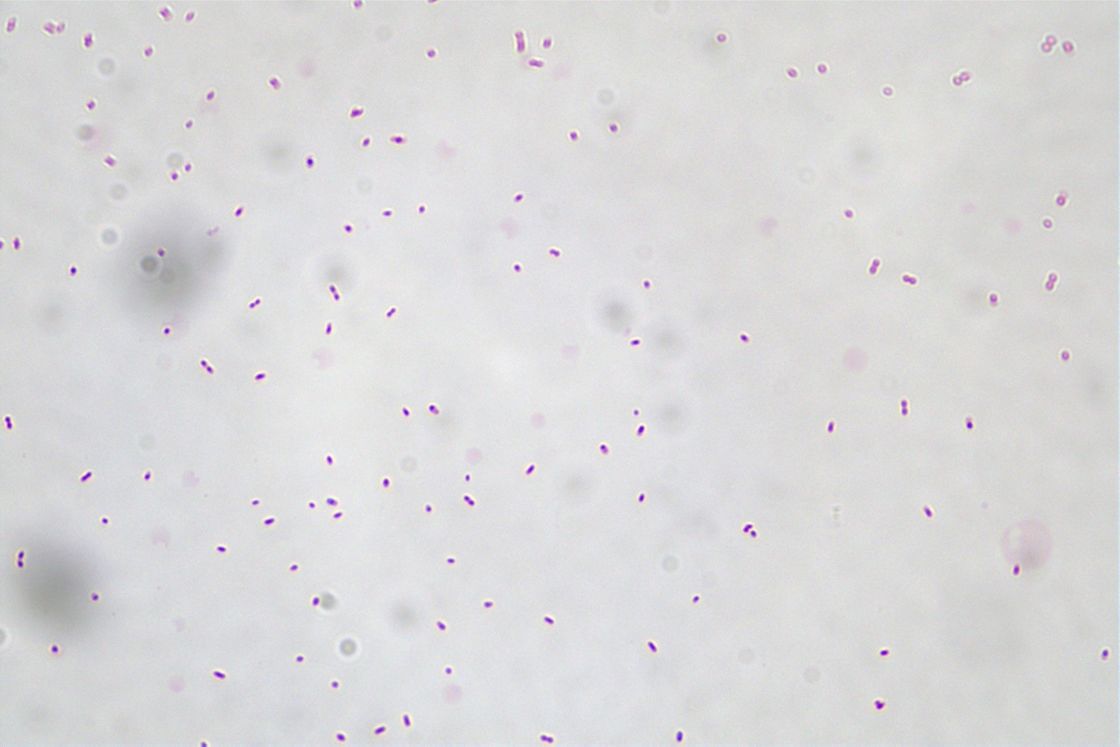Akkermansia Muciniphila AKK016 AKK Off White To Light Gray Powder/ Probiotics